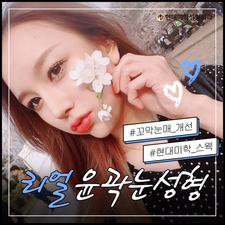 쌍꺼풀재수술가격 다시완성해요