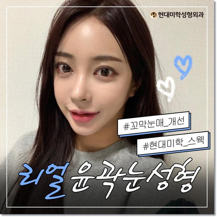 쌍꺼풀수술비용 만족을 보여드려요
