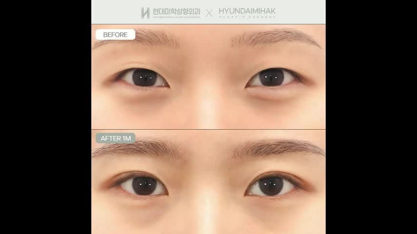 동영상