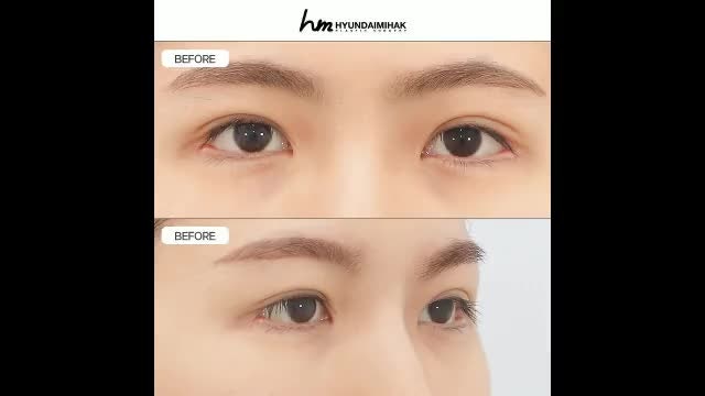 동영상