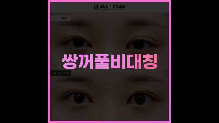 동영상