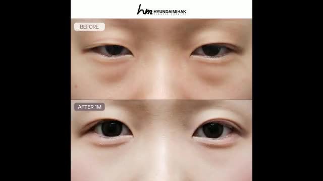 동영상