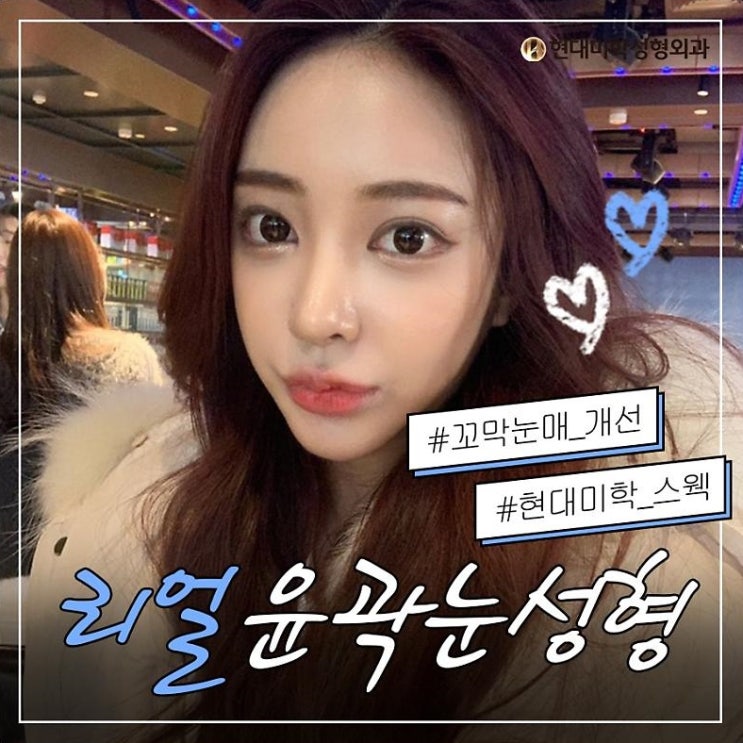 눈수술잘하는병원 어딘지 알아요