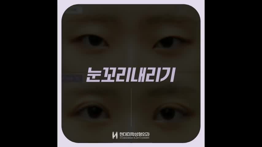 동영상