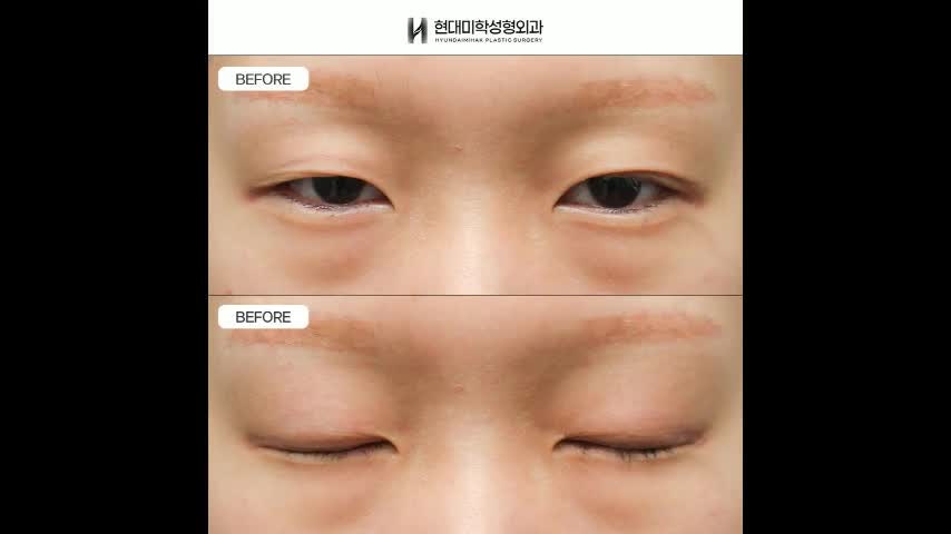 동영상