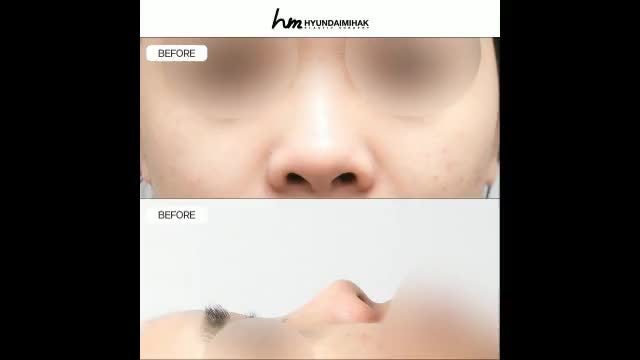 동영상