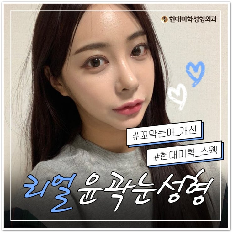 뒤밑트임 눈매를 완성하다