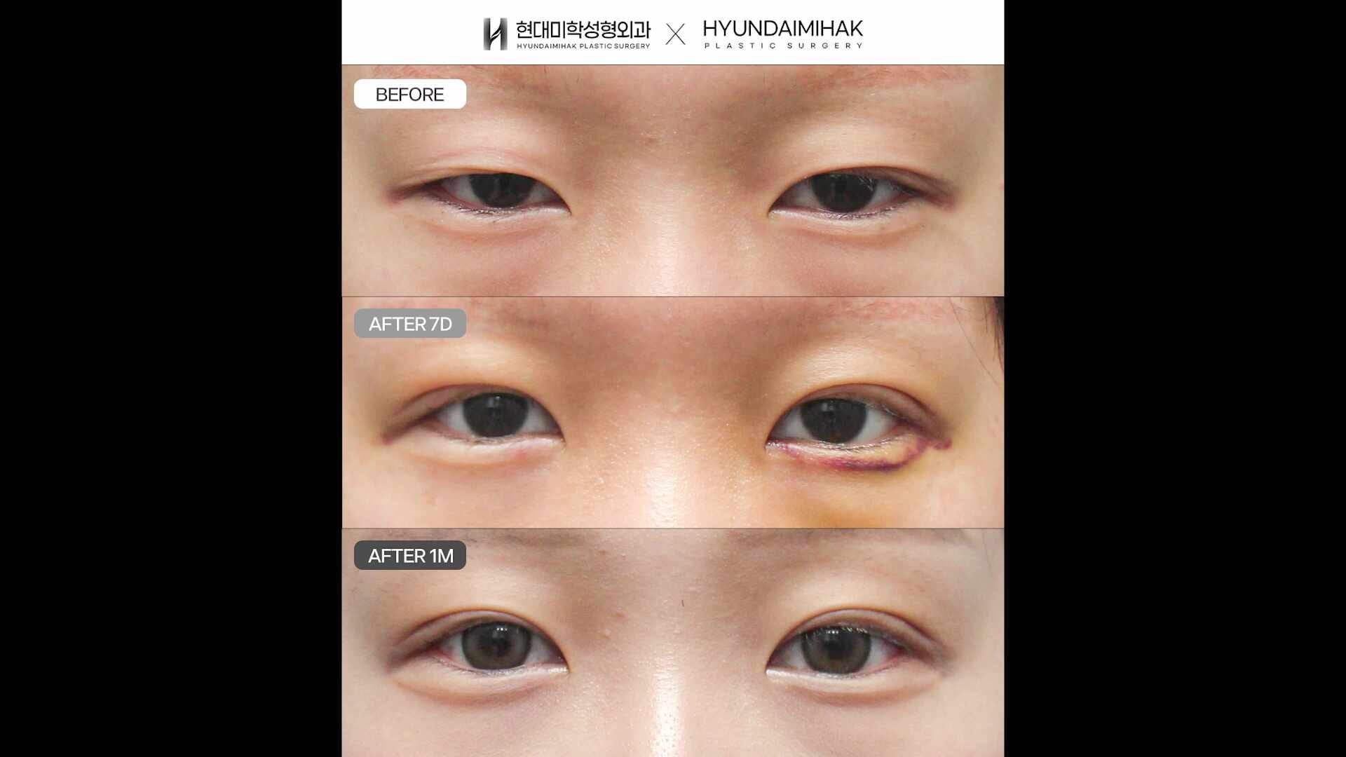 동영상