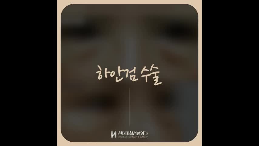 동영상
