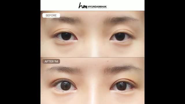 동영상