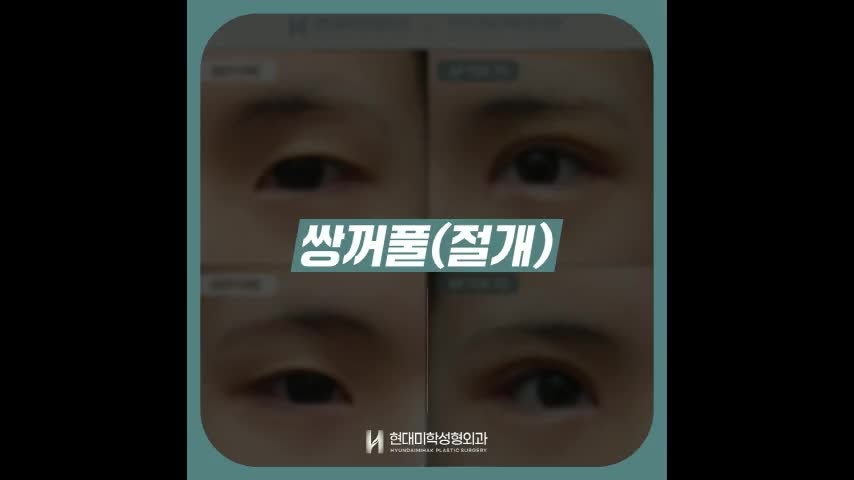 동영상
