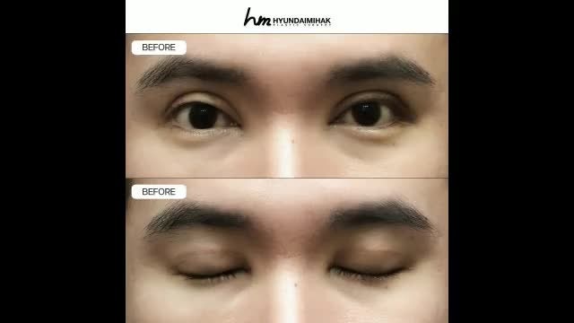 동영상