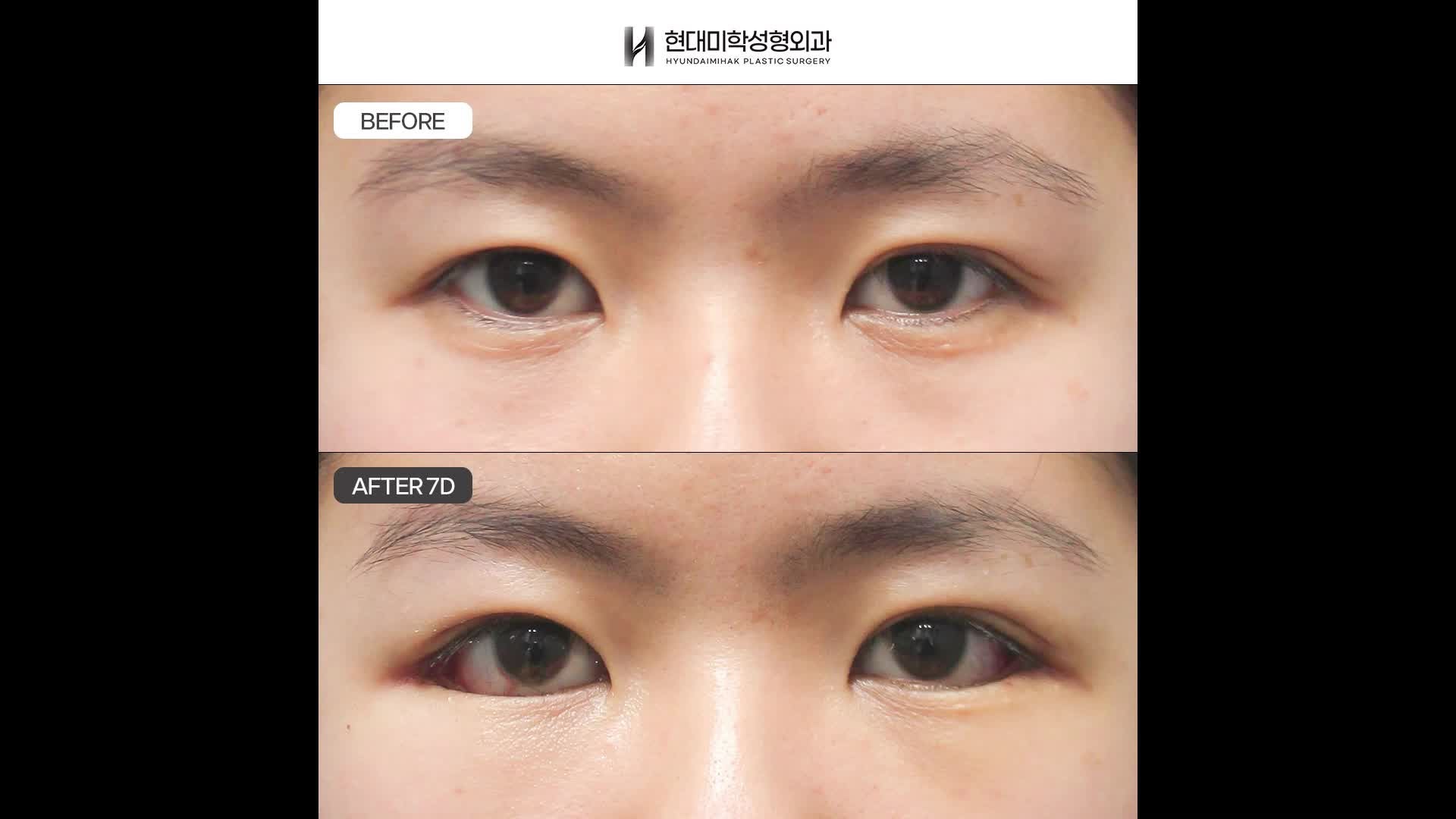 동영상