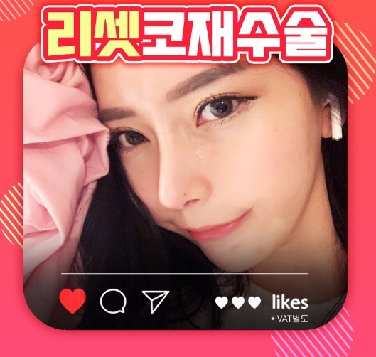 코재수술후기 이제 걱정은 없어