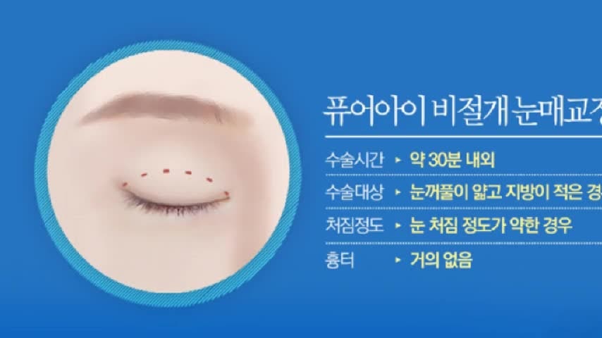 동영상