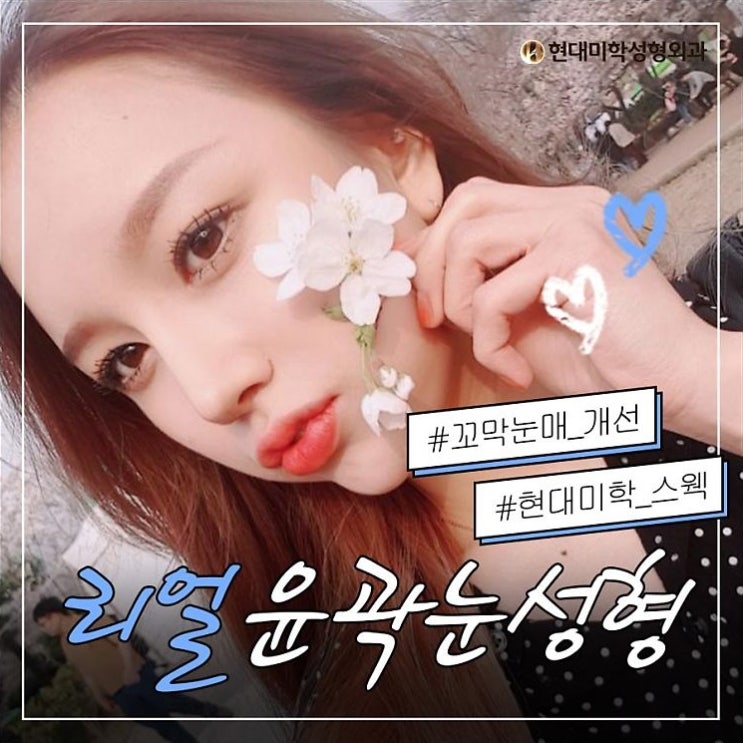 눈밑지방제거잘하는곳 젊어보여요