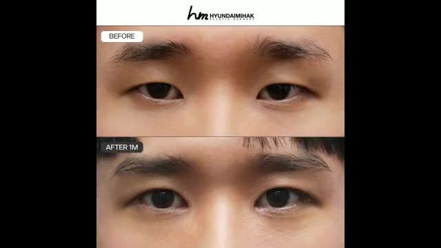 동영상