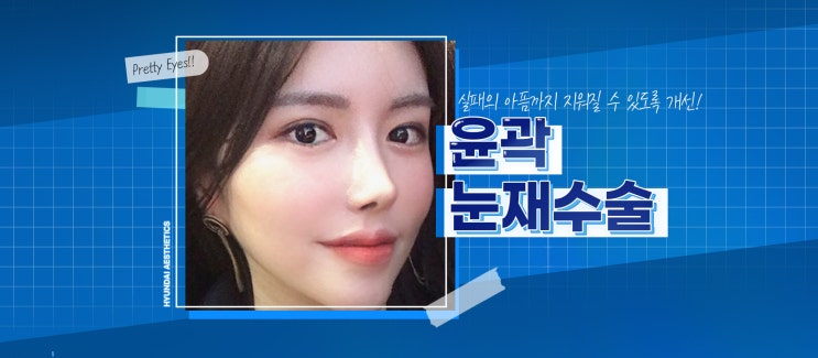 눈재수술 원인부터 파악해야