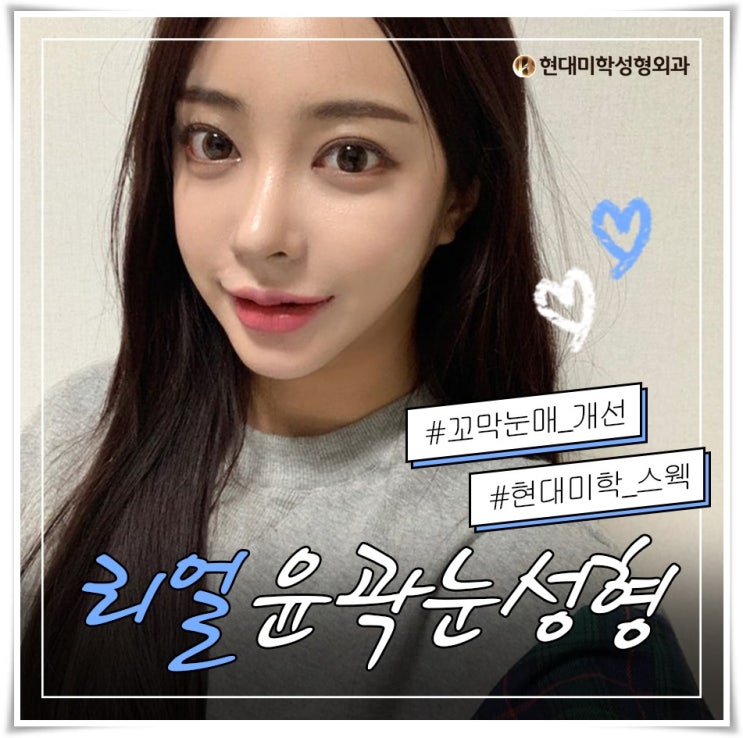 소세지눈재수술 눈뚠뚜니 이제 그만