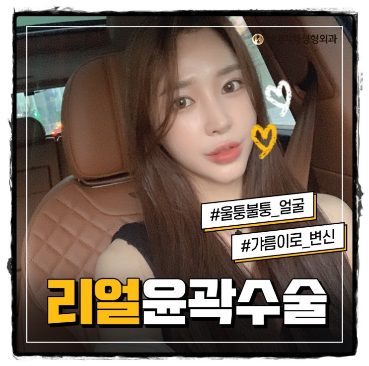 턱끝교정 미의 기준을 바로잡다