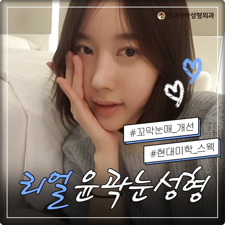 눈성형잘하는병원 예뻐지는 주문