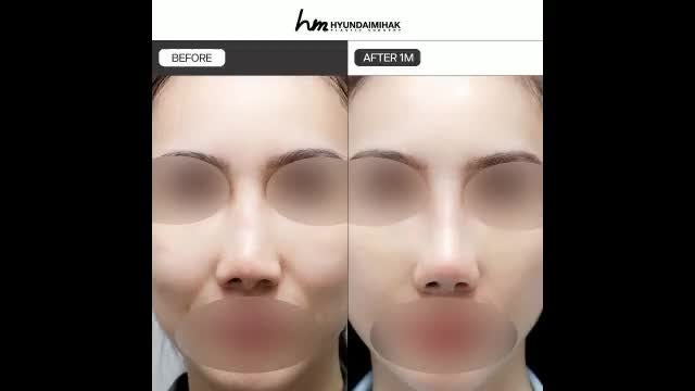 동영상