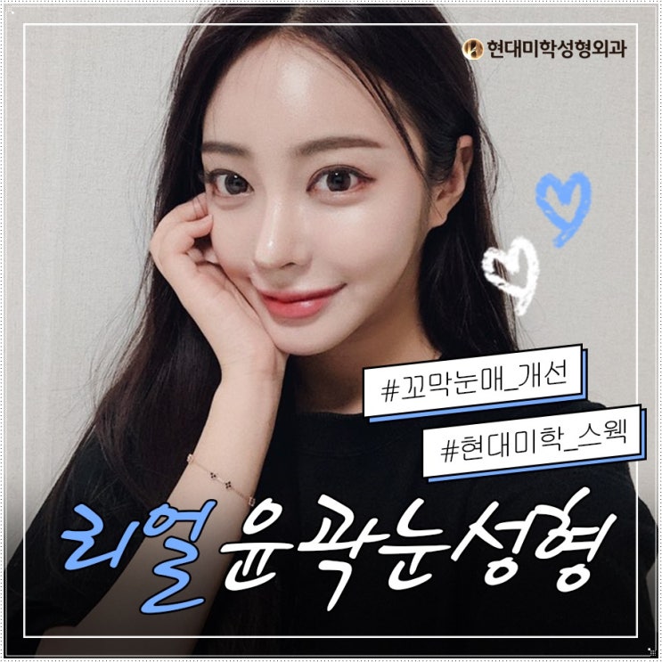 강남쌍꺼풀재수술 다시 찾아온 기회