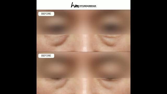 동영상