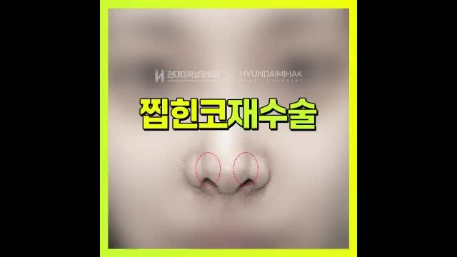 동영상