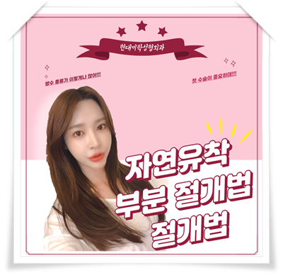 쌍수종류 어디까지 알아봤어?