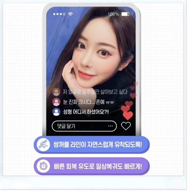 눈성형전후 제대로 달라야하지 않겠어요???