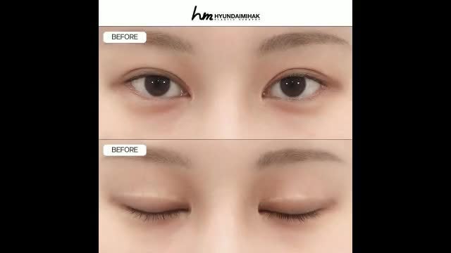 동영상