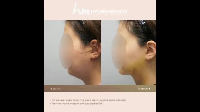 동영상