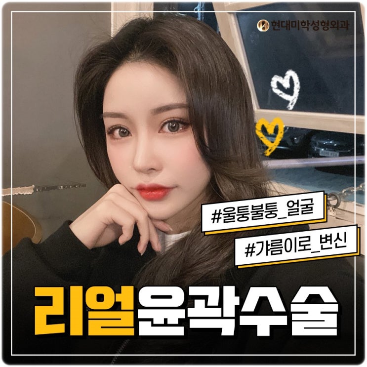 광대수술비용 현대미학 어서오고
