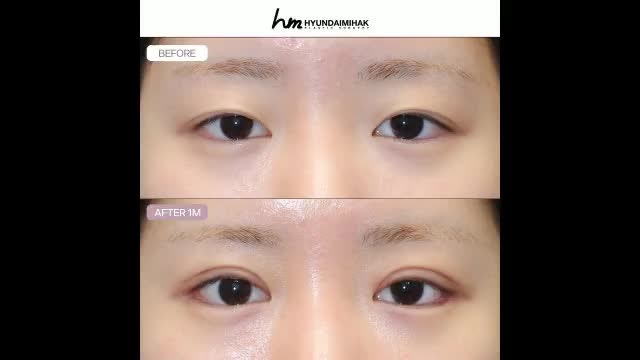 동영상