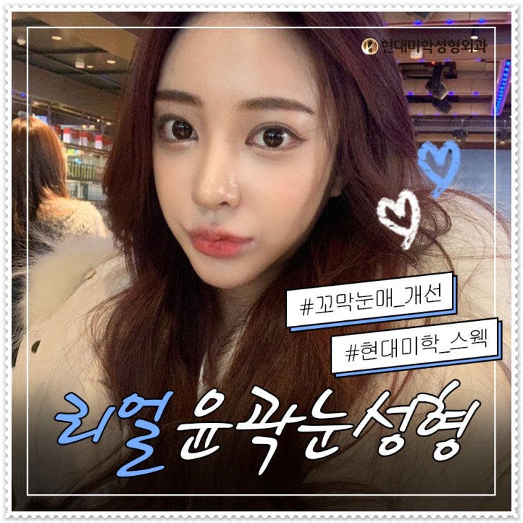 뒤트임밑트임 눈매의 완성은?