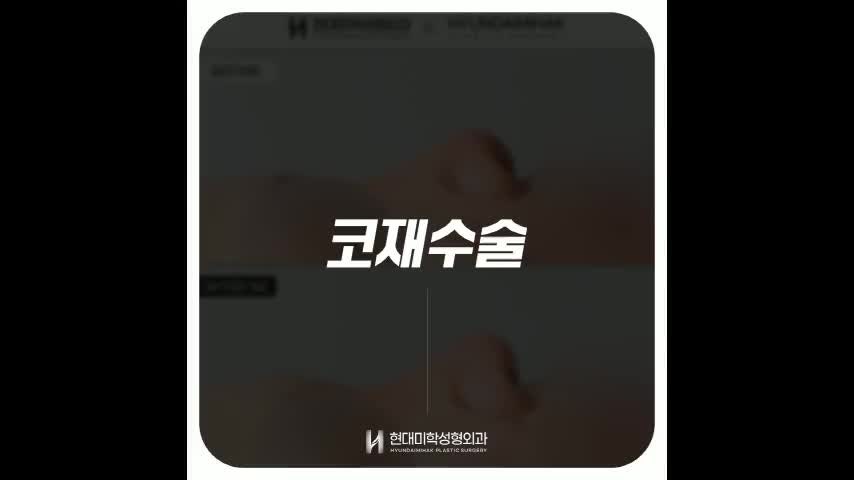 동영상