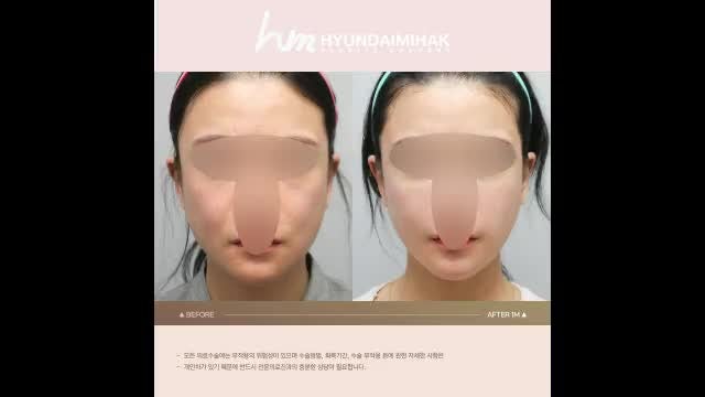 동영상