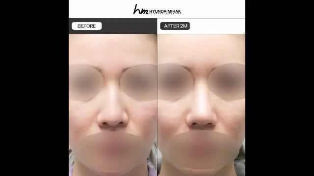 동영상