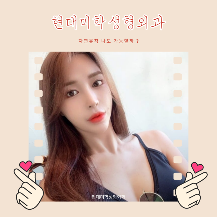 눈잘하는성형외과 나도 알고싶다.