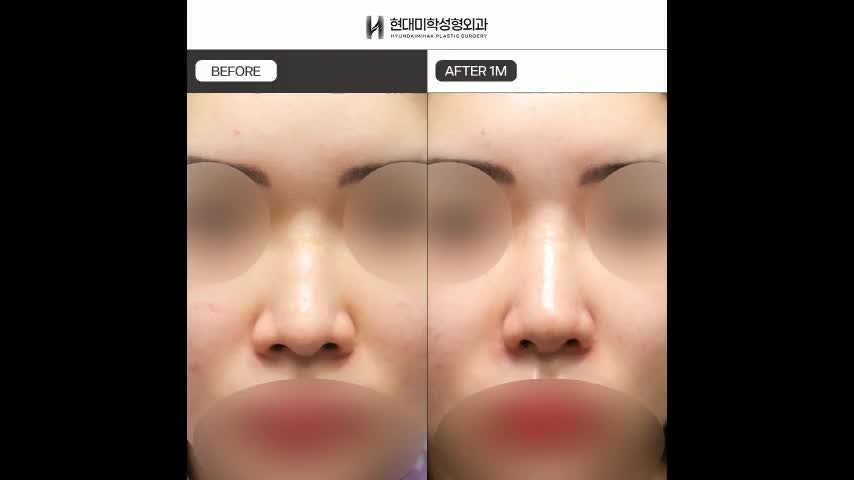 동영상