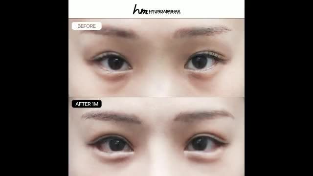 동영상