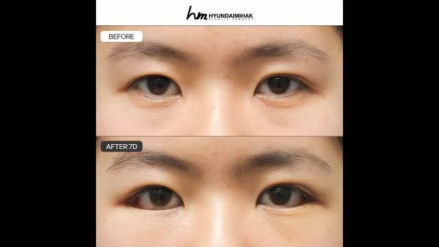 동영상