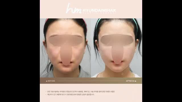 동영상
