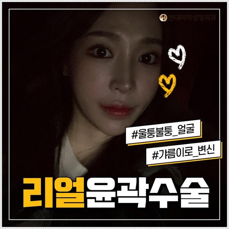 턱끝축소 똑똑하게 고르기