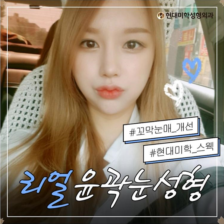 쌍수재수술가격 꼼꼼하게 알아봐요