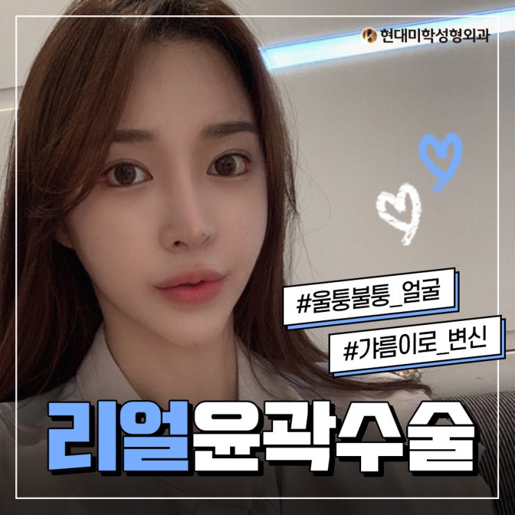 광대작아지는법 이렇게 좋아용