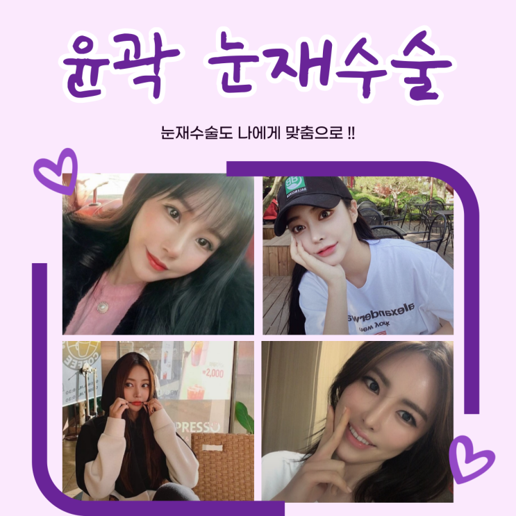 서울눈재수술 이것만큼은 알고가요.
