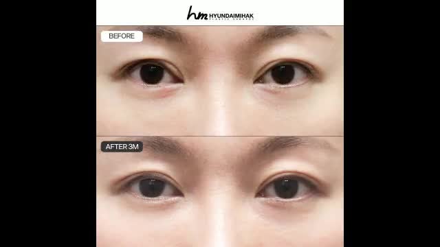 동영상
