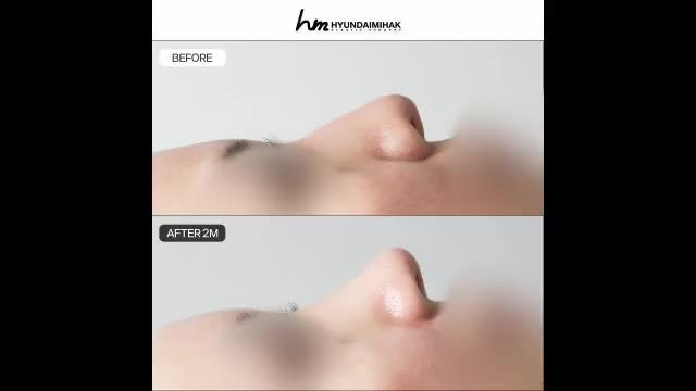 동영상